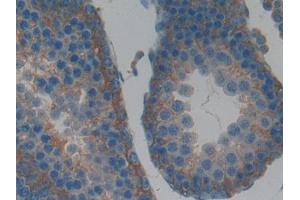 Used in DAB staining on fromalin fixed paraffin- embedded kidney tissue (LIFR anticorps  (AA 152-291))