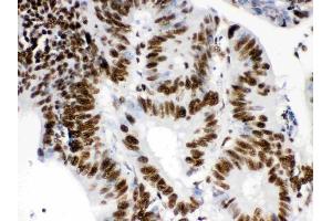 IHC analysis of RbAp48 using anti-RbAp48 antibody (ABIN3043920). (Retinoblastoma Binding Protein 4 anticorps  (C-Term))