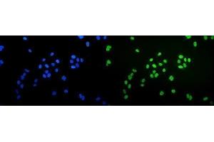 IF analysis of Ku70 using anti-Ku70 antibody (ABIN7602791).