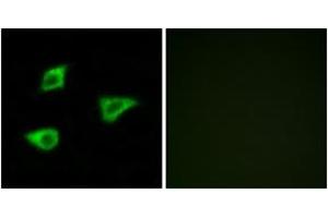 Immunofluorescence analysis of LOVO cells, using CHRM4 Antibody. (CHRM4 anticorps  (AA 236-285))