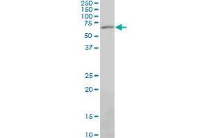 PAX7 monoclonal antibody (M06), clone 3H1. (PAX7 anticorps  (AA 411-520))