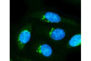 IF analysis of Alpha Internexin/INA using anti-Alpha Internexin/INA antibody (ABIN7602187). (INA anticorps  (AA 62-169))