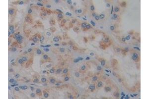 Detection of PTPRQ in Human Kidney Tissue using Polyclonal Antibody to Protein Tyrosine Phosphatase Receptor Type Q (PTPRQ)