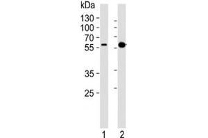 Western blot analysis of lysate from (1) A431 cell line and (2) mouse brain lysate using Pink1 antibody at 1:1000.