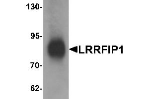 Western blot analysis of LRRFIP1 in human colon tissue lysate with LRRFIP1 antibody at 1 µg/mL. (LRRFIP1 anticorps  (C-Term))