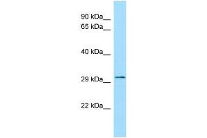 WB Suggested Anti-FLVCR2 Antibody Titration: 1. (FLVCR2 anticorps  (C-Term))