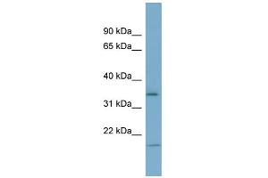 WB Suggested Anti-IGFBP2 Antibody Titration: 0. (IGFBP2 anticorps  (Middle Region))