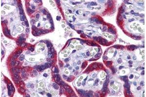 Human Placenta: Formalin-Fixed, Paraffin-Embedded (FFPE)