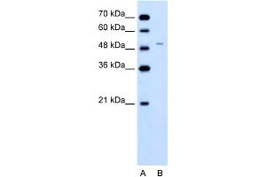WB Suggested Anti-FECH Antibody Titration:  0. (FECH anticorps  (N-Term))