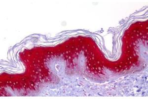 Anti-IVL / Involucrin antibody IHC staining of human skin.