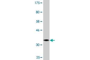 Western Blot detection against Immunogen (36. (AMPD2 anticorps  (AA 86-185))