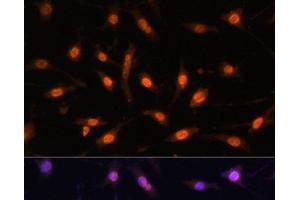 Immunofluorescence analysis of L929 cells using WT1 Polyclonal Antibody at dilution of 1:100. (WT1 anticorps)