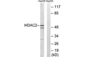 Western blot analysis of extracts from HepG2 cells, using HDAC2 (Ab-394) Antibody. (HDAC2 anticorps  (AA 360-409))