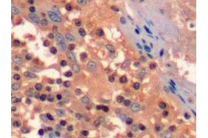 Detection of CD3d in Human Tonsil Tissue using Polyclonal Antibody to Cluster Of Differentiation 3d (CD3d)