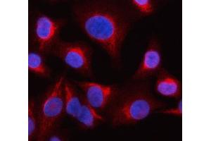 anti-Oculocerebrorenal Syndrome of Lowe (OCRL) (AA 1-901) antibody