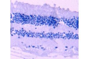 ABIN570667 Negative Control showing staining of paraffin embedded Human Retina, with no primary antibody. (ARR3 anticorps  (C-Term))