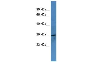 Western Blotting (WB) image for anti-Coagulation Factor VII (F7) (C-Term) antibody (ABIN2788316) (Factor VII anticorps  (C-Term))