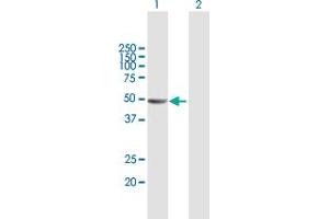 Western Blot analysis of KIAA1576 expression in transfected 293T cell line by KIAA1576 MaxPab polyclonal antibody. (VAT1L anticorps  (AA 1-419))