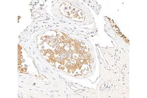 Immunohistochemistry (IHC) image for anti-Vinculin (VCL) (AA 1016-1066) antibody (ABIN7454836)