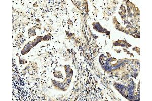 IHC analysis of BCKDK using anti-BCKDK antibody (ABIN7601470). (BCKDK anticorps  (AA 36-316))