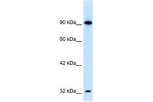 WB Suggested Anti-SOX30 Antibody Titration:  0. (SOX30 anticorps  (Middle Region))