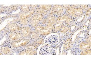 Detection of F12 in Human Kidney Tissue using Polyclonal Antibody to Coagulation Factor XII (F12) (F12 anticorps  (AA 400-615))