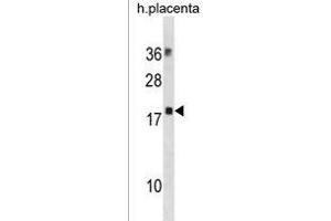 MYL12B Antibody (N-term) (ABIN1881561 and ABIN2838709) western blot analysis in human placenta tissue lysates (35 μg/lane). (MYL12B anticorps  (N-Term))
