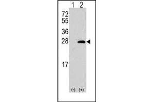 Image no. 1 for anti-sigma Non-Opioid Intracellular Receptor 1 (SIGMAR1) (Middle Region) antibody (ABIN357897) (SIGMAR1 anticorps  (Middle Region))