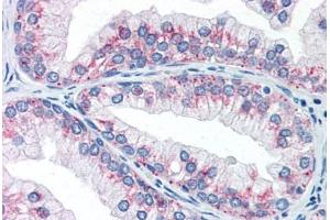 Human Prostate (formalin-fixed, paraffin-embedded) stained with AKT1S1 antibody ABIN337263 at 10 ug/ml followed by biotinylated anti-mouse IgG secondary antibody ABIN481714, alkaline phosphatase-streptavidin and chromogen.