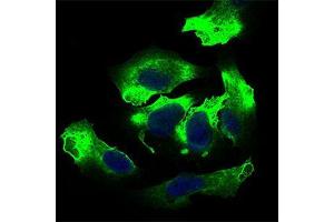 Immunofluorescence analysis of Hela cells using ALCAM mouse mAb (green).