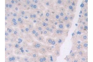 Detection of ATF6 in Mouse Liver Tissue using Polyclonal Antibody to Activating Transcription Factor 6 (ATF6)