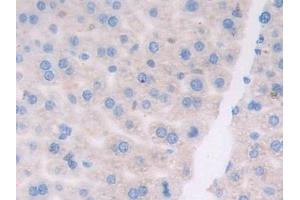 Detection of ATF6 in Mouse Liver Tissue using Polyclonal Antibody to Activating Transcription Factor 6 (ATF6) (ATF6 anticorps  (AA 1-377))