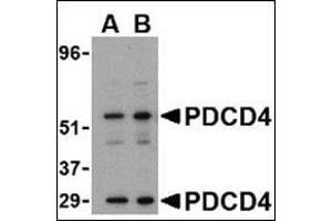 Western blot analysis of PDCD4 in A-20 cell lysate with this product at (A) 0. (PDCD4 anticorps  (C-Term))