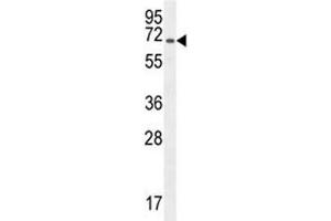 CD31 antibody western blot analysis in CHO lysate.