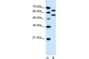 WB Suggested Anti-SIL1 Antibody Titration:  0. (SIL1 anticorps  (N-Term))