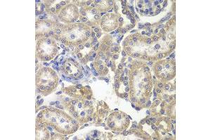 Immunohistochemistry of paraffin-embedded rat kidney using H6PD antibody at dilution of 1:200 (400x lens). (Glucose-6-Phosphate Dehydrogenase anticorps)