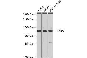 Western blot analysis of extracts of various cell lines, using CARS antibody (ABIN6129260, ABIN6137946, ABIN6137948 and ABIN6222203) at 1:1000 dilution. (CARS anticorps  (AA 469-748))