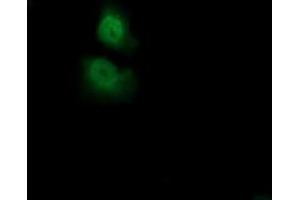 Immunofluorescence (IF) image for anti-Acireductone Dioxygenase 1 (ADI1) antibody (ABIN1496483) (ADI1 anticorps)