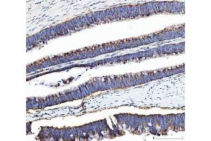 IHC analysis of UBA5 using anti-UBA5 antibody (ABIN7601503). (UBA5 anticorps  (AA 37-389))