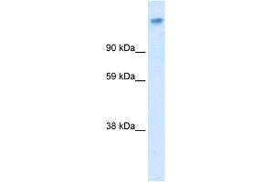 WB Suggested Anti-CACNA2D1 Antibody Titration:  0. (CACNA2D1 anticorps  (Middle Region))