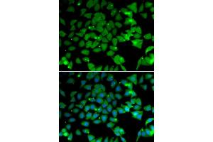 anti-ARD1 Homolog, N-Acetyltransferase (ARD1A) (AA 161-235) antibody