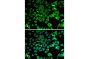 Immunofluorescence analysis of U2OS cells using N antibody (ABIN6129932, ABIN6144318, ABIN6144319 and ABIN6222781).