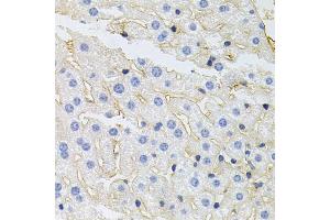 Immunohistochemistry of paraffin-embedded mouse liver using IGF1R antibody (ABIN5970073) at dilution of 1/100 (40x lens). (IGF1R anticorps  (N-Term))