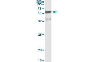 Immunoprecipitation of WARS transfected lysate using anti-WARS monoclonal antibody and Protein A Magnetic Bead , and immunoblotted with WARS MaxPab rabbit polyclonal antibody.