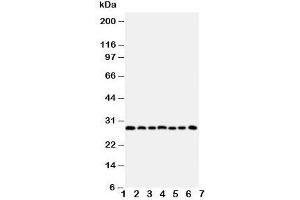 Western blot testing of Kallikrein-11 antibody and Lane 1:  U87;  2: A549; 3: HeLa;  4: MM231;  5: MM453;  6: COLO320;  7: Jurkat cell lysate. (Kallikrein 11 anticorps  (C-Term))