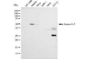 Western blotting analysis using Aquaporin 1 antibody (ABIN7797637).
