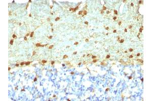 Formalin-fixed, paraffin-embedded Rat Brain stained with Fascin-1 Mouse Monoclonal Antibody (FSCN1/418).