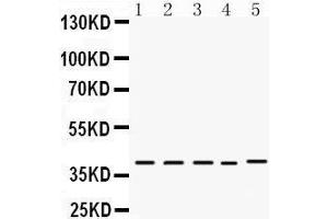 Western Blotting (WB) image for anti-Doublesex and Mab-3 Related Transcription Factor 1 (DMRT1) (AA 98-128), (N-Term) antibody (ABIN3043450) (DMRT1 anticorps  (N-Term))