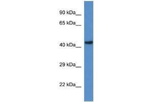 WB Suggested Anti-Gcdh Antibody   Titration: 1. (GCDH anticorps  (C-Term))