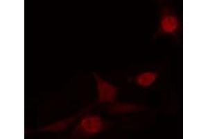 ABIN6274231 staining HT29 cells by IF/ICC. (FOXN2 anticorps  (C-Term))